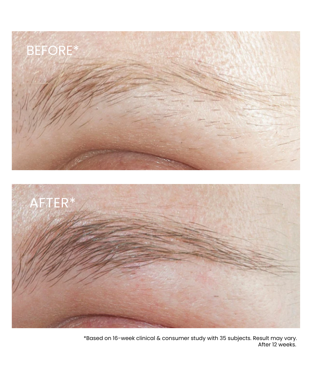 Essential Brow Serum